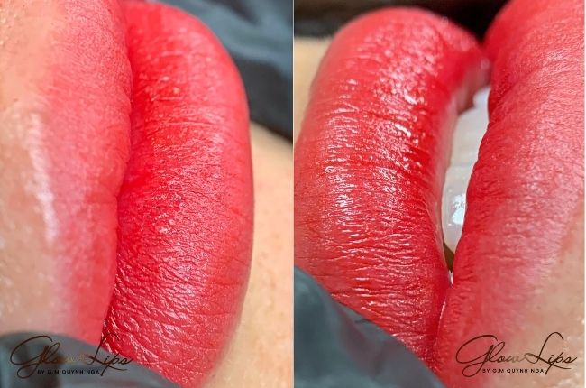 ky-thuat-phun-moi-khong-te (2)